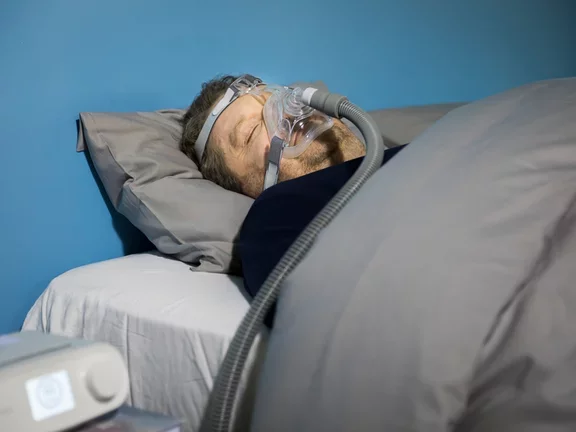 Sleep apnea male patient (sleeping) 10